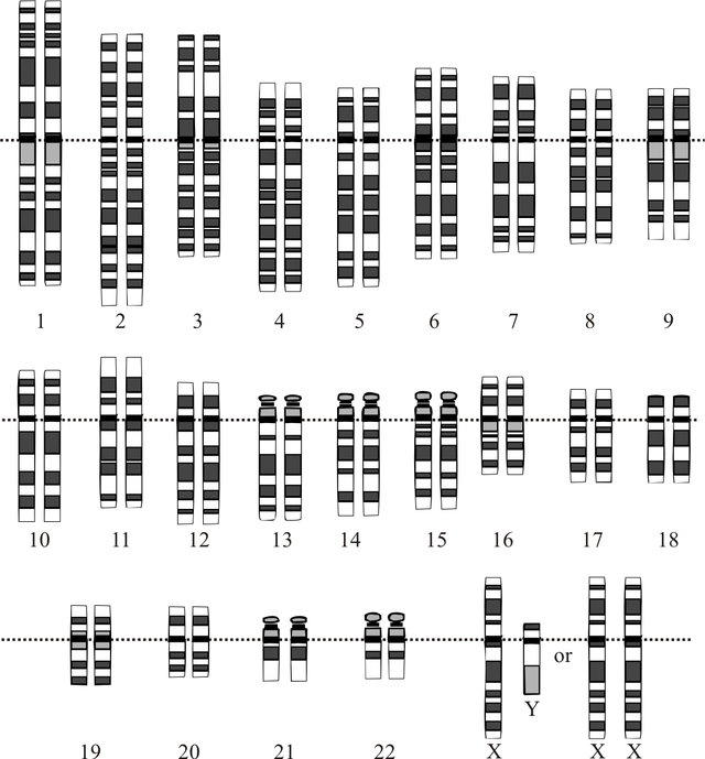 640px-Karyotype
